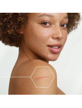 EPITHELIALE ULTRA REPAIR Crema antimarcas